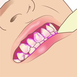 染めのイメージ（＊イラスト：改築工房さん）